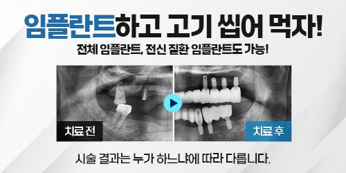 임플라인치과의원 평촌점 5번째 이미지