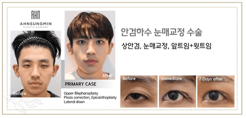 안성민성형외과의원 7번째 이미지