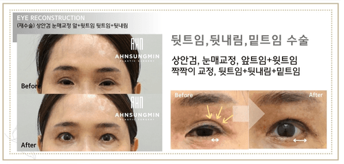 안성민성형외과의원 8번째 이미지