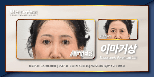 눈높이성형외과의원 2번째 이미지