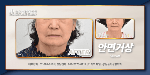 눈높이성형외과의원 3번째 이미지