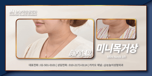 눈높이성형외과의원 4번째 이미지