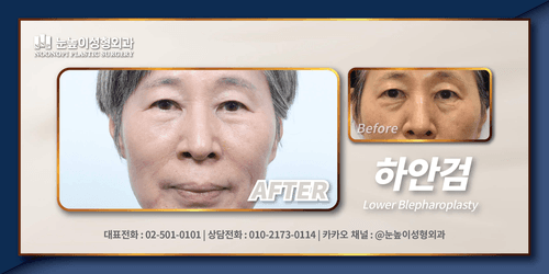 눈높이성형외과의원 5번째 이미지
