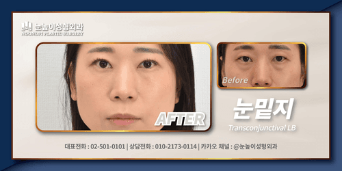 눈높이성형외과의원 6번째 이미지