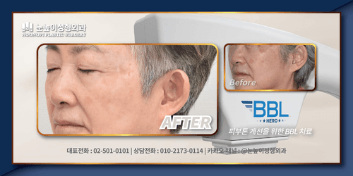 눈높이성형외과의원 8번째 이미지