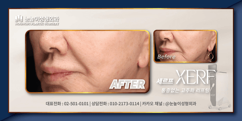 눈높이성형외과의원 9번째 이미지