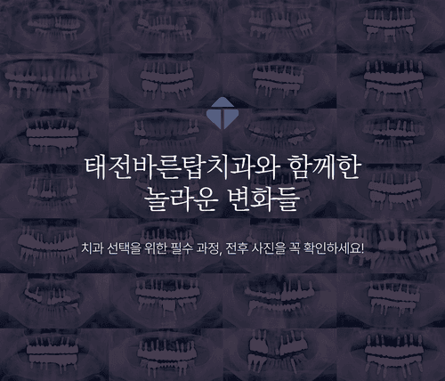 태전바른탑치과의원 5번째 이미지