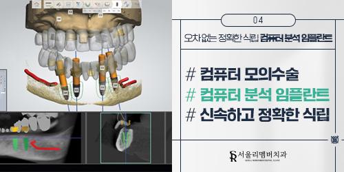 서울리멤버치과의원 6번째 이미지