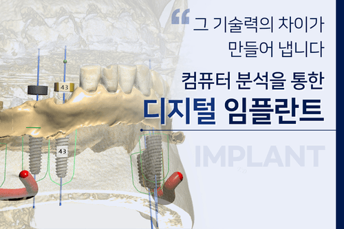 인생플란트치과의원 2번째 이미지