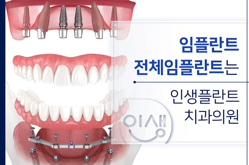 인생플란트치과의원 3번째 이미지
