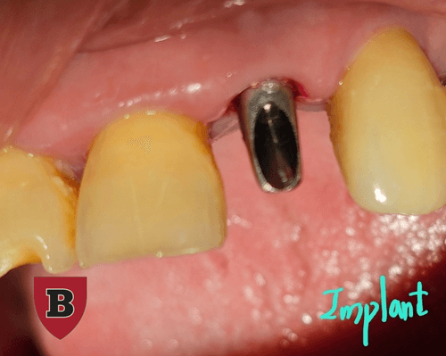 365보스턴치과의원 3번째 이미지