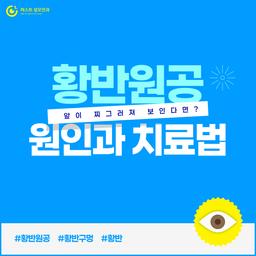 앞이 찌그러져 보인다면? 황반원공 원인과 치료 정리의 썸네일