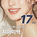 치아미백_이미지