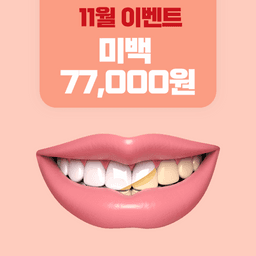 치아미백_이미지