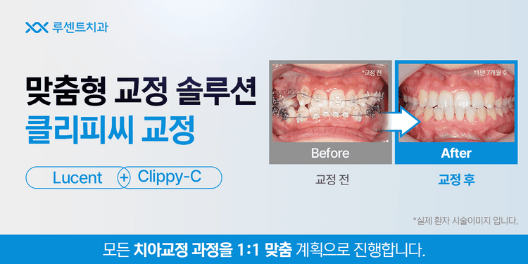 루센트치과의원 대표이미지