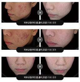 오가나셀 피부과의원 청담본점